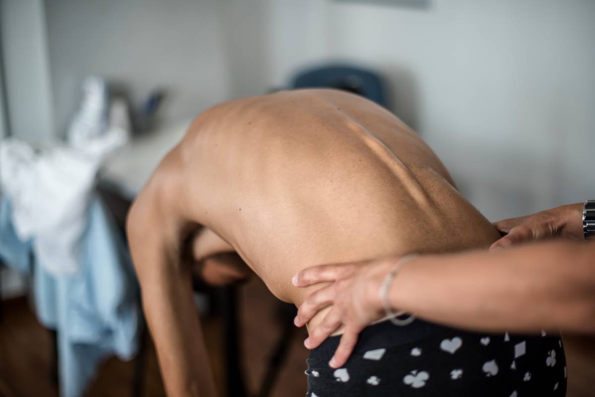 Avoid Surgery: Managing Adjacent Segment Disease 1 AdjacentSegmentDisease