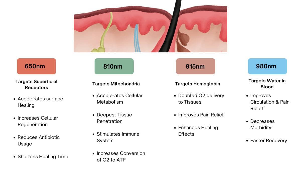 How Class IV Laser Helps With Diabetic Neuropathy? 1 HowClassIVLaserHelpsWithDiabeticNeuropath1