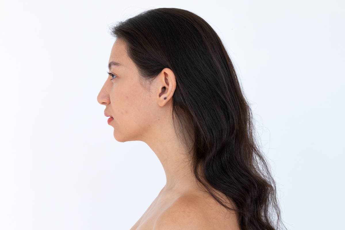 What Is a Reversed Cervical Curve? Find Out Here 1 Reversed Cervical Curve