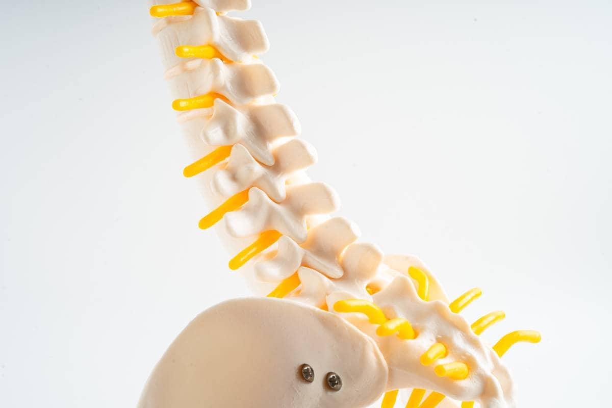 The Stages of Cervical and Lumbar Spine Degeneration 1 stages of cervical and lumbar spine degeneration